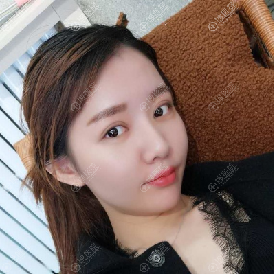 无锡割双眼皮哪家医院好推荐无锡<!--<i data=20240710 data-id=1918></i>--> 无锡割双眼皮哪家医院好推荐无锡<!--<i data=20240710 data-id=1918></i>-->