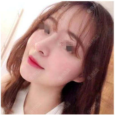 ����ޱ��ҽ���������ı��ۺ�¡�ǰ���