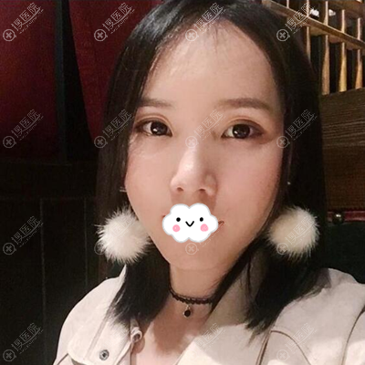 ����������ռ������֬���沿�������һ����