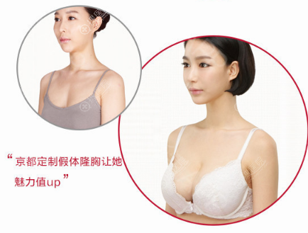 保定京都隆胸案例 保定京都隆胸案例