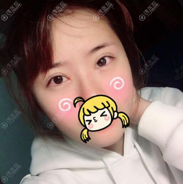 <!--<i data=20240710 data-id=11606></i>-->医院孙宇做双眼皮怎么样 <!--<i data=20240710 data-id=11606></i>-->医院孙宇做双眼皮怎么样