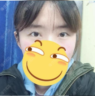 找上海仁爱医院整形科孙宇做完双眼皮后拿到一份2019整形价格表