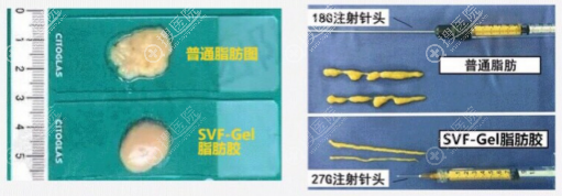 脂肪和脂肪胶的对比图 脂肪和脂肪胶的对比图