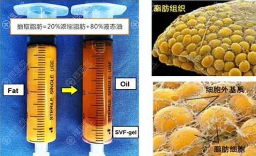 SVF-Gel脂肪胶图片 SVF-Gel脂肪胶图片