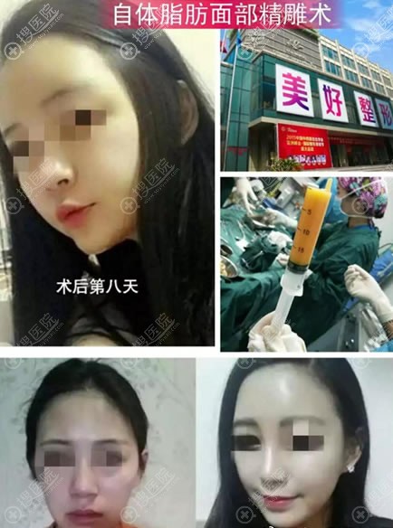������������������֬����䰸��