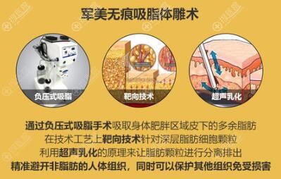 想到广州军美医疗美容做吸脂的亲们, 2019医美月全新价格表来啦