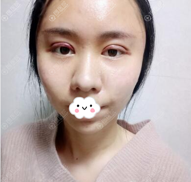 �軤��˫��Ƥ���۽�����һ��