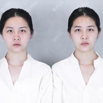 �˱�������˫��̥������˫��Ƥǰ
