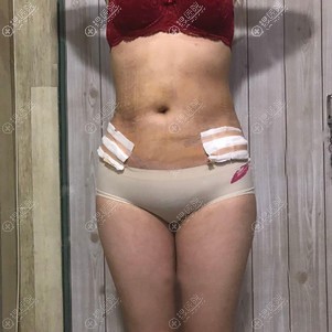 ��֬������ʮ���ʱ��׼������