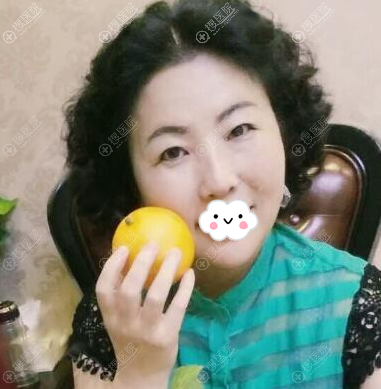 <!--<i data=20240710 data-id=12045></i>-->陈瑞红线雕术后一个恢复图 <!--<i data=20240710 data-id=12045></i>-->陈瑞红线雕术后一个恢复图