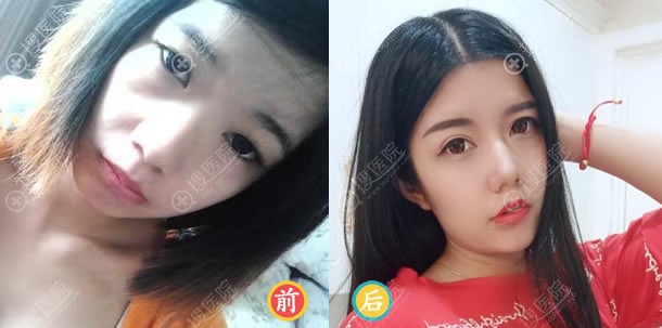 ��ݸά�����Ǽ���¡�ǰ����Ա�ͼ