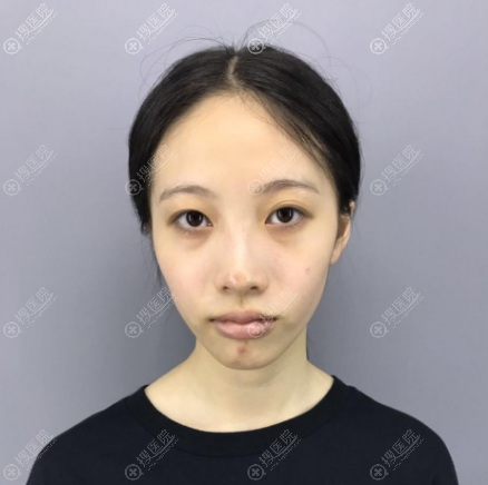 �����첬������������ȫ��˫��Ƥ�������ڰ���������Ƥ������