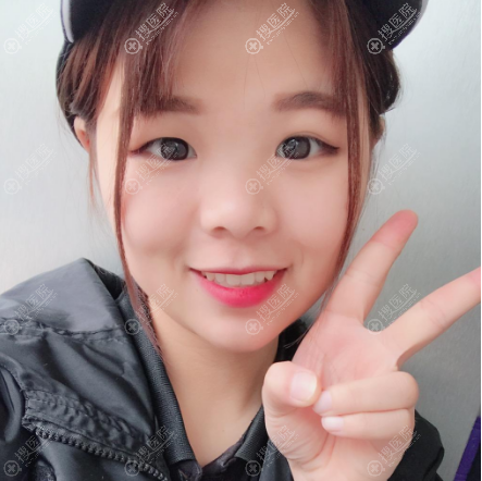 在杭州时光朱若宁和范眉清中间选择朱若宁医生做了双眼皮和隆鼻