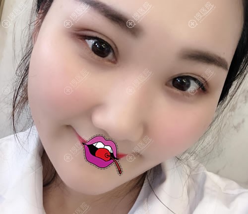<!--<i data=20240710 data-id=11903></i>-->王晓敏开眼角案例 <!--<i data=20240710 data-id=11903></i>-->王晓敏开眼角案例