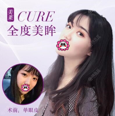 ��������˫��ƤЧ���Ա�
