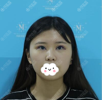 �ൺ����������־˫��Ƥ���۽����󼴿�