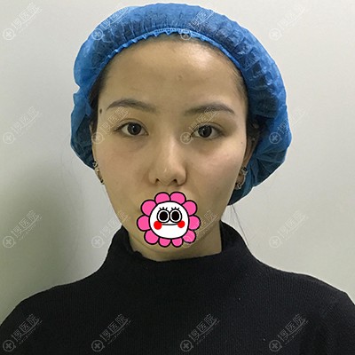 �½���³ľ������������֬���沿���ǰ