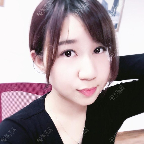 <!--<i data=20240710 data-id=11915></i>-->双眼皮效果怎么样? <!--<i data=20240710 data-id=11915></i>-->双眼皮效果怎么样?