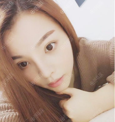 ������ɳ��֮��������˫��Ƥ¡����ô��