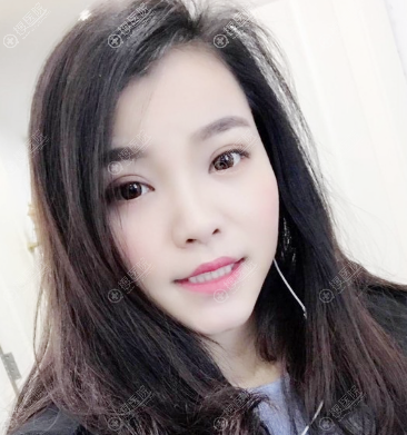 ��ɳ��֮��������˫��Ƥ¡����������