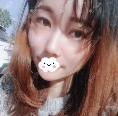 <!--<i data=20240710 data-id=12006></i>-->吴东辉面填案例 <!--<i data=20240710 data-id=12006></i>-->吴东辉面填案例