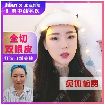 <!--<i data=20240710 data-id=12082></i>-->郑栋宇医生双眼皮<span style= <!--<i data=20240710 data-id=12082></i>-->郑栋宇医生双眼皮<span style=