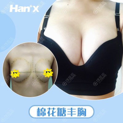 <!--<i data=20240710 data-id=12082></i>-->侯泽民医生隆胸<span style= <!--<i data=20240710 data-id=12082></i>-->侯泽民医生隆胸<span style=