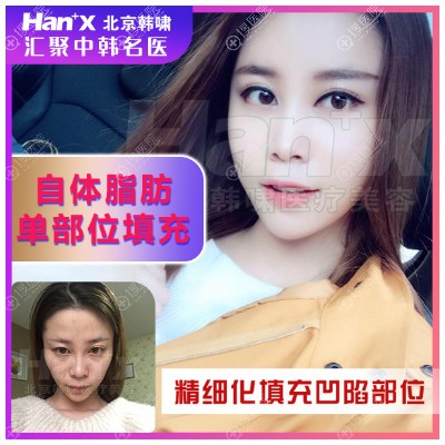 <!--<i data=20240710 data-id=12082></i>--><!--<i data=20240710 data-id=16444></i>-->医生自体脂肪面部填充<span style= <!--<i data=20240710 data-id=12082></i>--><!--<i data=20240710 data-id=16444></i>-->医生自体脂肪面部填充<span style=