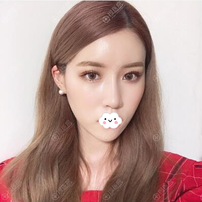 ����NANA����ҽԺ�����hȫ������Ч��