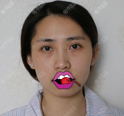 �ڱ�������ҽԺ������֬�����ƻ����+���۴�+���°��������