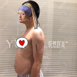 ϱ���ڱ�����Ȼҽ����������֬��¡��,�����������������֬��