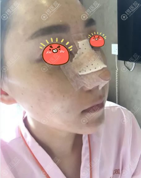 �������Ǳ��ۺ�¡����������Ч��