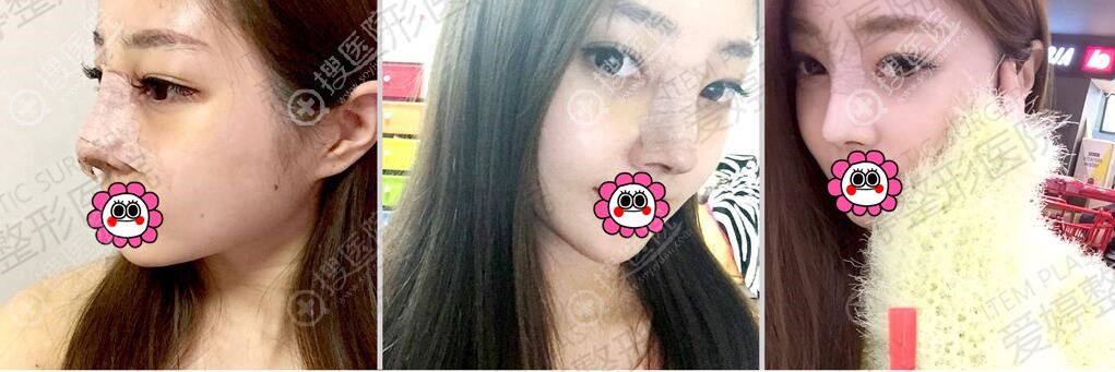 ���޸�1<span style=