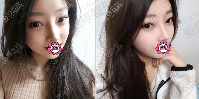 �ǲ��ָ�һ����Ч��
