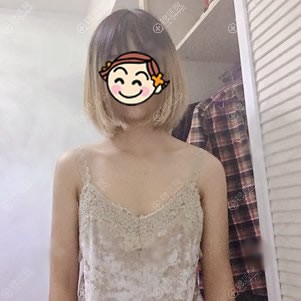 谈谈我的亲身经历:几万元找重庆好美刘正茂做曼托毛面假体隆胸