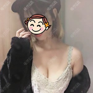 重庆好美假体隆胸案例20天效果 重庆好美假体隆胸案例20天效果