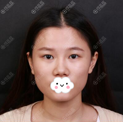 不满自己的眼睛鼻子,我打算做整形手术 不满自己的眼睛鼻子,我打算做整形手术