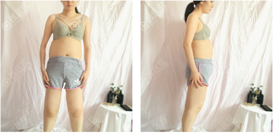 �Ͼ���֬�ļҺã��������Ͼ������������Ĵ�����֬������֪��