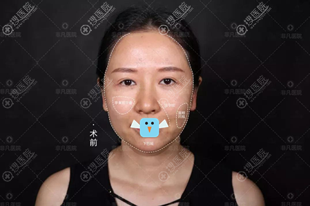 �鱦���ʦ����Ů�������ռǿ����ڷǷ�����ҽ���ƴ��ߵ���ô��