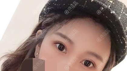 ���ڹ�����˫��Ƥ����������Ƭ