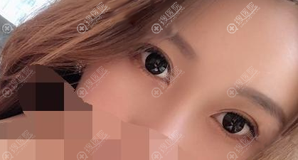 ���ھ�����ï����������˫��Ƥ����Ч��