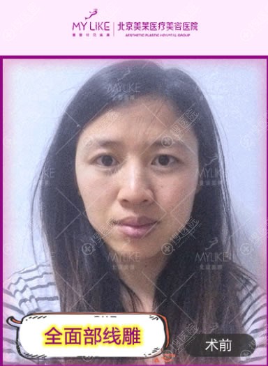 ��˵�ߵ�ܻ�,���ܵ�������������ȫ�沿�ߵ�������Ч���ò���