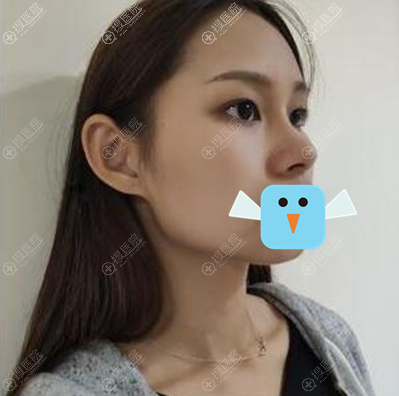 �����������ܺ鳬����¡��+���������� �������ӵ��˶�û������