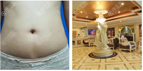 �ɶ���֬ҽԺ���˳ɶ�����֮��,�ɶ����ƾ���ʿ��֬Ч��Ҳ����