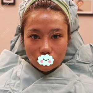 �������沿�ߵ�������Ч��ͼƬ