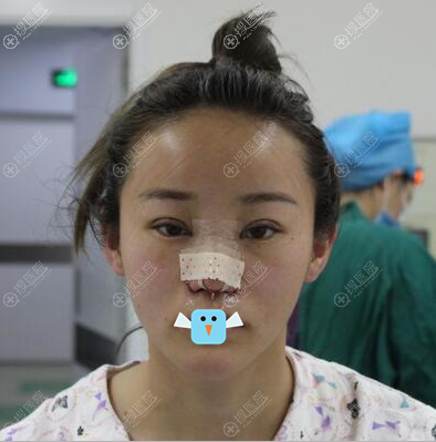 清潭FIRST李丙玟眼睛鼻子整形术后即刻效果图 清潭FIRST李丙玟眼睛鼻子整形术后即刻效果图