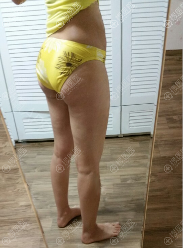 �������ں���365mc��֬ҽԺ������˹LAMS����С����֬��������