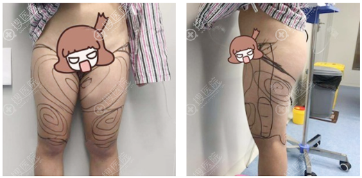 ������������ںϷ�Ҽ�������Ĵ�����֬Ч��,Ϊ���ҽ������