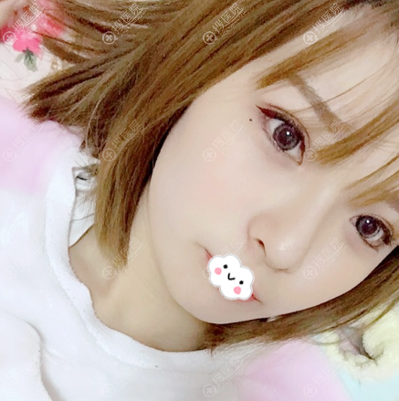 <!--<i data=20240710 data-id=11912></i>-->医疗美容医院做双眼皮怎么样 <!--<i data=20240710 data-id=11912></i>-->医疗美容医院做双眼皮怎么样