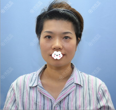 ������ϣ˼ʯ������֬��������沿֬������ƾ���Ϊ��ʵ��ǿ